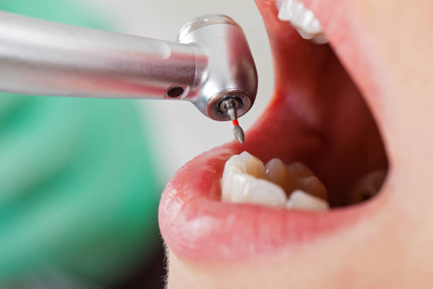 Best Tooth Infection Emergency Dentist  in Remgton, IN